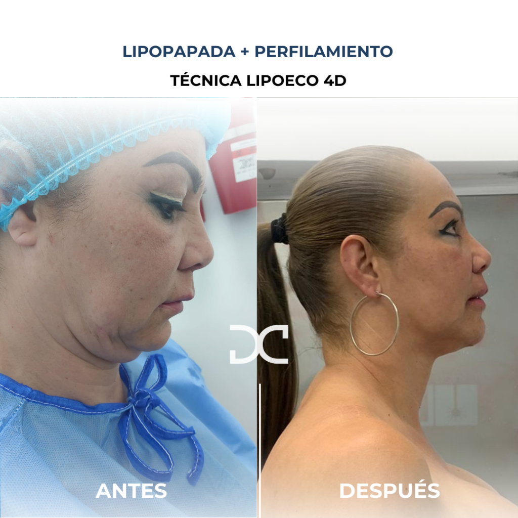 Copia de Añadir un subtítulo (5)
